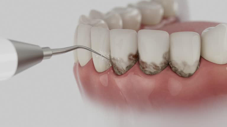 Trusted Teeth Cleaning And Checkup service in Seville, OH - Dentist Open Now